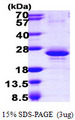 RBM8A / Y14 Protein