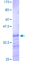 RBMS1 Protein - 12.5% SDS-PAGE Stained with Coomassie Blue.