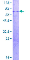 RBMS2 / SCR3 Protein - 12.5% SDS-PAGE of human RBMS2 stained with Coomassie Blue