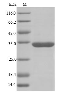 RBMX Protein - (Tris-Glycine gel) Discontinuous SDS-PAGE (reduced) with 5% enrichment gel and 15% separation gel.