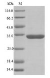 RBMX Protein - (Tris-Glycine gel) Discontinuous SDS-PAGE (reduced) with 5% enrichment gel and 15% separation gel.