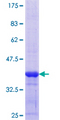 RBMY1A1 Protein - 12.5% SDS-PAGE Stained with Coomassie Blue.