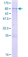 RBMY1F Protein - 12.5% SDS-PAGE of human RBMY1F stained with Coomassie Blue