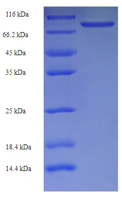 RBMY1F Protein