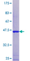 RBP1 / CRBP Protein - 12.5% SDS-PAGE of human RBP1 stained with Coomassie Blue