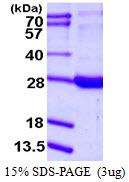 RBP1 / CRBP Protein