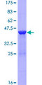 RBP2 / CRBPII Protein - 12.5% SDS-PAGE of human RBP2 stained with Coomassie Blue