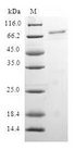 RBP2 / CRBPII Protein - (Tris-Glycine gel) Discontinuous SDS-PAGE (reduced) with 5% enrichment gel and 15% separation gel.