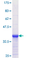 RBP2 / CRBPII Protein - 12.5% SDS-PAGE Stained with Coomassie Blue.
