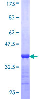 RBP3 / IRBP Protein - 12.5% SDS-PAGE Stained with Coomassie Blue.