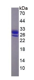 RBP4 Protein - Eukaryotic Retinol Binding Protein 4, Plasma By SDS-PAGE