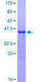RBP4 Protein - 12.5% SDS-PAGE of human RBP4 stained with Coomassie Blue