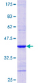 RBP4 Protein - 12.5% SDS-PAGE Stained with Coomassie Blue.