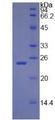 RBP4 Protein - Recombinant Retinol Binding Protein 4, Plasma By SDS-PAGE