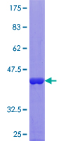 RBP5 Protein - 12.5% SDS-PAGE of human RBP5 stained with Coomassie Blue