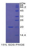 RBP5 Protein - Recombinant Retinol Binding Protein 5, Cellular By SDS-PAGE