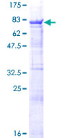 RBPJ Protein - 12.5% SDS-PAGE of human RBPJ stained with Coomassie Blue