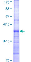 RBPJ Protein - 12.5% SDS-PAGE Stained with Coomassie Blue.