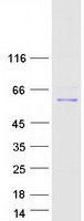 RBPJ Protein - Purified recombinant protein RBPJ was analyzed by SDS-PAGE gel and Coomassie Blue Staining