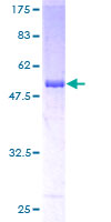 RBPMS / Hermes Protein - 12.5% SDS-PAGE of human RBPMS stained with Coomassie Blue