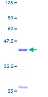 RBX1 / ROC1 Protein - 12.5% SDS-PAGE of human RBX1 stained with Coomassie Blue