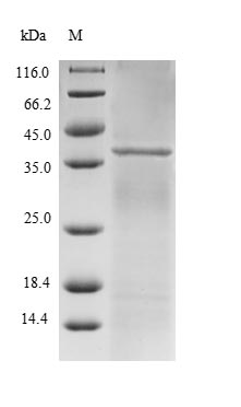 RBX1 / ROC1 Protein - (Tris-Glycine gel) Discontinuous SDS-PAGE (reduced) with 5% enrichment gel and 15% separation gel.