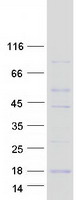 RBX1 / ROC1 Protein - Purified recombinant protein RBX1 was analyzed by SDS-PAGE gel and Coomassie Blue Staining