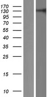 RC3H2 Protein - Western validation with an anti-DDK antibody * L: Control HEK293 lysate R: Over-expression lysate