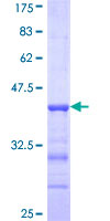 RC3H2 Protein - 12.5% SDS-PAGE Stained with Coomassie Blue.