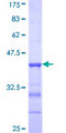 RC3H2 Protein - 12.5% SDS-PAGE Stained with Coomassie Blue.