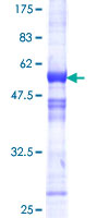 RCAN1 / DSCR1 Protein - 12.5% SDS-PAGE of human DSCR1 stained with Coomassie Blue