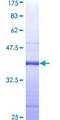 RCAN1 / DSCR1 Protein - 12.5% SDS-PAGE Stained with Coomassie Blue.