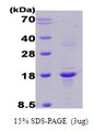 RCAN1 / DSCR1 Protein