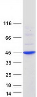 RCAN1 / DSCR1 Protein - Purified recombinant protein RCAN1 was analyzed by SDS-PAGE gel and Coomassie Blue Staining