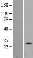RCAN2 / RCN2 Protein - Western validation with an anti-DDK antibody * L: Control HEK293 lysate R: Over-expression lysate