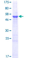 RCAN2 / RCN2 Protein - 12.5% SDS-PAGE of human DSCR1L1 stained with Coomassie Blue