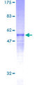 RCAN3 / Calcipressin 3 Protein - 12.5% SDS-PAGE of human DSCR1L2 stained with Coomassie Blue