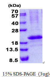 RCAN3 / Calcipressin 3 Protein