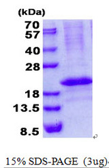 RCAN3 / Calcipressin 3 Protein