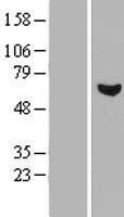 RCBTB1 Protein - Western validation with an anti-DDK antibody * L: Control HEK293 lysate R: Over-expression lysate