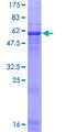 RCBTB1 Protein - 12.5% SDS-PAGE of human RCBTB1 stained with Coomassie Blue