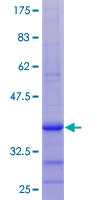 RCBTB1 Protein - 12.5% SDS-PAGE Stained with Coomassie Blue.