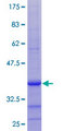 RCBTB1 Protein - 12.5% SDS-PAGE Stained with Coomassie Blue.