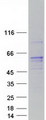 RCBTB1 Protein - Purified recombinant protein RCBTB1 was analyzed by SDS-PAGE gel and Coomassie Blue Staining