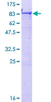RCBTB2 Protein - 12.5% SDS-PAGE of human RCBTB2 stained with Coomassie Blue