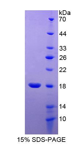 RCBTB2 Protein - Recombinant RCC1 And BTB Domain Containing Protein 2 By SDS-PAGE