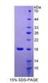 RCBTB2 Protein - Recombinant RCC1 And BTB Domain Containing Protein 2 By SDS-PAGE
