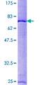 RCC1 Protein - 12.5% SDS-PAGE of human RCC1 stained with Coomassie Blue