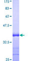 RCC1 Protein - 12.5% SDS-PAGE Stained with Coomassie Blue.
