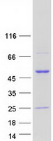 RCC1 Protein - Purified recombinant protein RCC1 was analyzed by SDS-PAGE gel and Coomassie Blue Staining